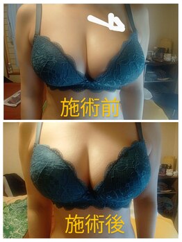 リラックスジュリー/バストケア