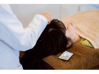 マーキュリー(Mercury)/頭皮鍼