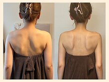 ラフリー 武蔵小杉院(RUFFREE)/肩甲骨のシルエットが美しく