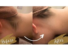 チャンティック(Cantik)/うなじケア