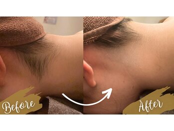 チャンティック(Cantik)/うなじケア