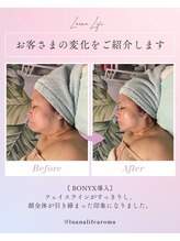 ルアナライフ(Luana Life)/【たるみ・あご肉改善】Bonyx