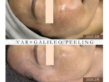 ルームエイトエイティスリー 新宿(R883)/1年のエイジングケアの結果