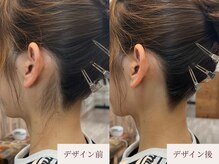 クラームビューティー(Clerm beauty)/美容師によるうなじデザイン脱毛