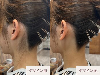 クラームビューティー(Clerm beauty)/美容師によるうなじデザイン脱毛