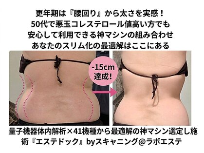 スキャニング@ラボエステの写真