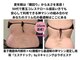 スキャニング@ラボエステの写真