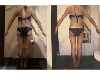 パーフェクトボディプレミアム 大阪難波店(PERFECT BODY PREMIUM)/お客様 ビフォーアフター(30)