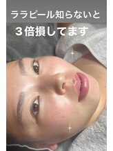 エステティックサロン グリーンアイ 浦和店(green.i)/ララピール／小顔/たるみ/毛穴／