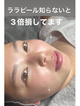 エステティックサロン グリーンアイ 浦和店(green.i)/ララピール/小顔/たるみ/毛穴/
