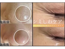 ホワイトアクア 中目黒店(WHITE AQUA)の雰囲気（ゴワつき、毛穴引き締め、シミしわケアお任せください！）