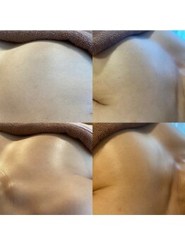 ララルアナ(Lara luana)/1回で実感