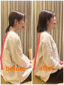 若松整体院 太白区院/猫背矯正★