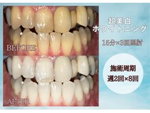 四国健康村 宇多津店の雰囲気（【お風呂・サウナ付き♪ホワイトニング15分×3回照射】￥2,200～）