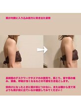 トトノエル(TOTONOEL)/巻き肩/猫背などの姿勢矯正