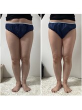 ポラス(Polus)/下半身痩身