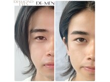 ダイヤモンドアイズ グランツリー武蔵小杉店(DIAMOND EYES)の雰囲気（眉ケアトリートメント(眉ワックス）/眉毛サロン/メンズ眉）