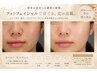 【韓国肌管理×フォト美顔】最上級の自分へのご褒美コース