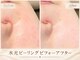 ポノエール(Pono Elle)の写真/【話題の水光ピーリング】韓国の芸能人のような発光美肌へ♪剥離なしの最新肌管理で驚きのツヤと透明感!
