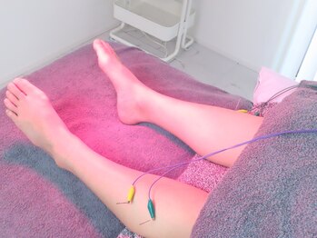 ハリスト 茅ヶ崎(Haristo)/ふくらはぎにも鍼と微弱電流を♪