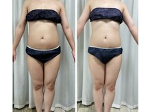 毒素を流すと気になる浮腫んだウエストもスッキリ☆痩せ体質に。