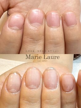 マリーロール 梅田店(Marie Laure)/自爪育成/深爪矯正/ネイルケア