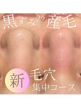 ウィズティ 沖縄市店(with.T)/毛穴集中コース