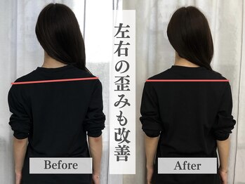 アライメント 自由が丘(Alignment)/左右差の改善（姿勢矯正）