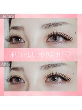 コトリ(kotori)/デザインキープラッシュ