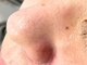 ドクターエイチ 大阪本町店(Doctor.H)の写真/【年齢や肌質に合わせた毛穴改善特化プログラム】丁寧なカウンセリングで原因追究し、改善して毛穴レス♪