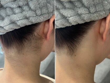 フェイシャルクレア(Cre A.)の写真