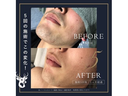 グランズ 芦屋(GLANZ)の写真