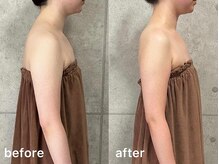 ミヌレ 大阪店(minulle)/身体の厚みが薄くなる