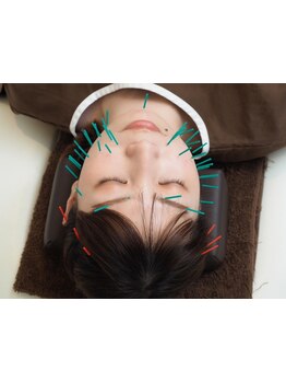 小顔になりたい