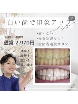 ライトビューティー 本八幡店(LIGHT BEAUTY)/難しい歯の系統もお任せください