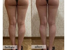 エステサロン ジョアアンジェ(joie ange)/ポールシェリー痩身　6回