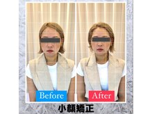 ルーツ 赤羽店(R∞ts)/小顔矯正/個貌術