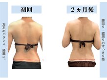 ビオラス 高崎店/華奢な後ろ姿を叶えます！