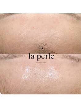 ラペール 岡山店(la perle)/コルギ×●●