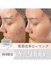 【迷ったらこちら】本気の肌質改善◆剥離なしピーリング7種