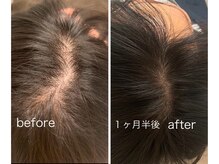 ルミア(LUMIA)の雰囲気(何を試しても効果を感じられなかった方もぜひお試しください☆)