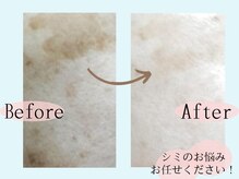 ゴールデンケア 岡崎店(Golden Care)の雰囲気（光フェイシャルで毛穴/シミ/シワを根本改善！（シミ・ニキビ））