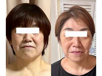 リシェカ(Richeka)/一年半の軌跡