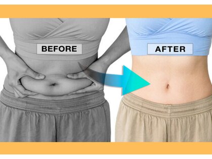 ヨサパーク トゥインクル(YOSAPARK twinkle)の写真