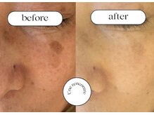 ユヌランコント 岐阜店(Une rencontre)/シミケアマシーン導入店！