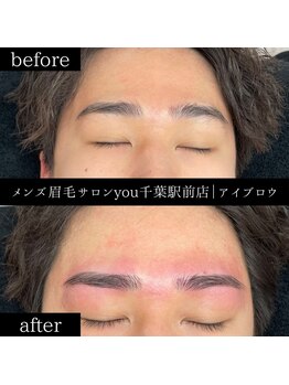 ユー 千葉駅前店(you)/ビフォ－アフター写真