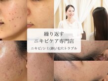 ミリアージュ(Miliage)