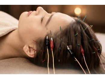 カドモリ 銀座(KADOMORI)の写真/【睡眠矯正】脳疲労・睡眠の質UP｜鍼を使用したワンランク上の睡眠に特化した頭のケアです