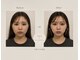 バルーム 北千住店(Baloom)の写真/【人気No.1美容整体】顔左右差&大きさ改善◎骨盤矯正+小顔矯正 ￥15,900→￥2,800 [美容整体/北千住]
