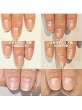 ニコプラス(NICO+)/自爪育成中